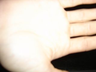 Zipfel h�lt seine Hand vor die Kamera