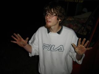 Dieses Zeug auf den H�nden durfte ich bis zum n�chsten Tag abpopeln