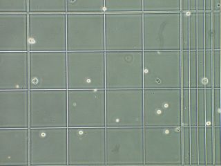 Zellen in der Z�hlkammer